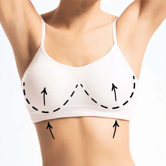 know-more-about-Breast Lift-treatment-in-Noida
